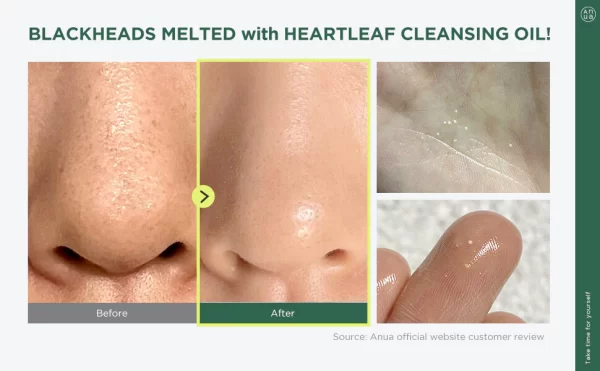 Anua Heartleaf Cleansing Oil - Imagen 2