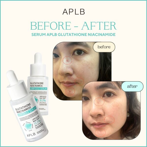 APLB Glutathione Niacinamide Serum - Imagen 2